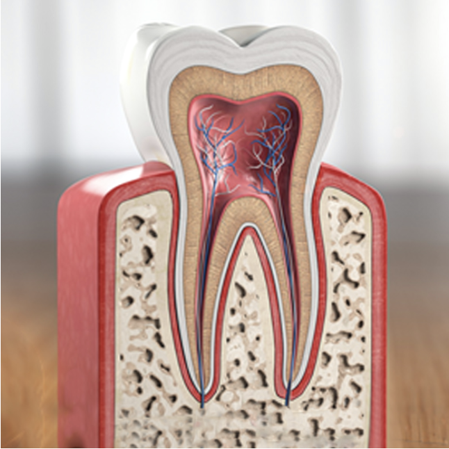 Clear aligner dental treatment