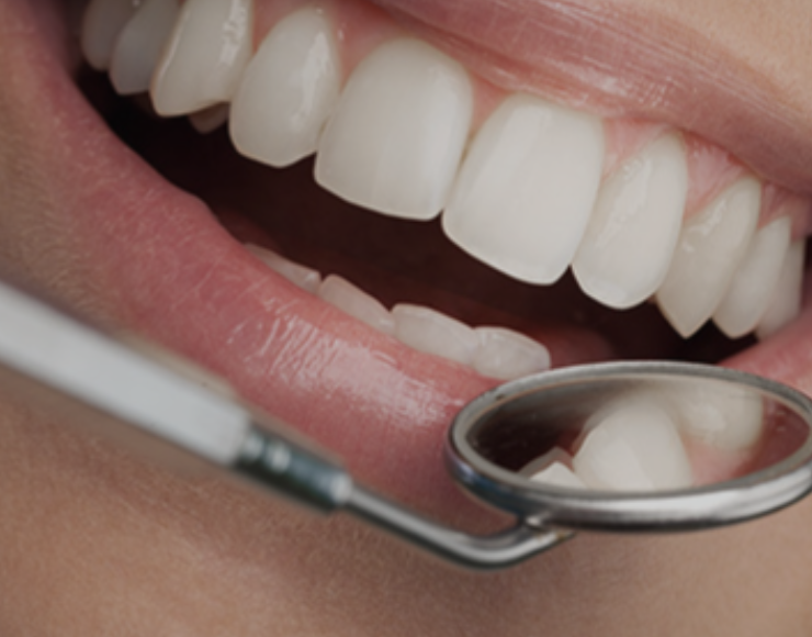 Digital dental treatment planning
